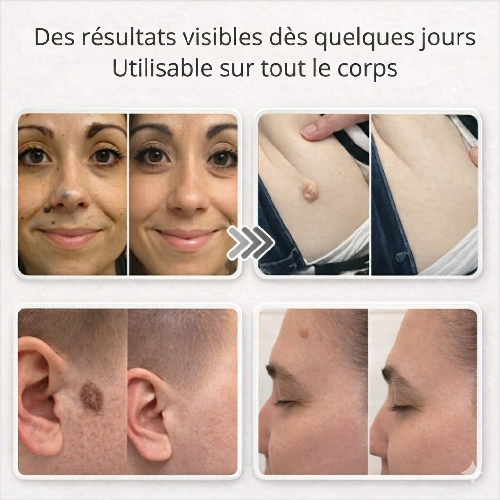 Lovera Care - Pansements pour la Peau