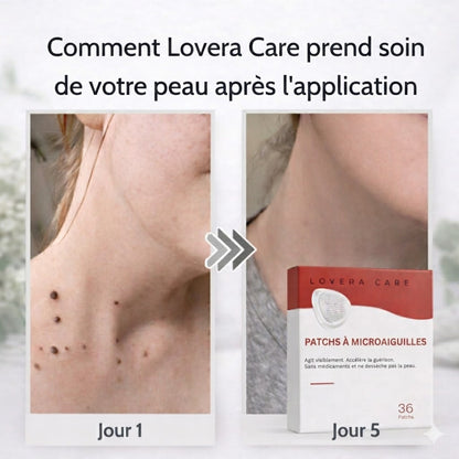 Lovera Care - Pansements pour la Peau
