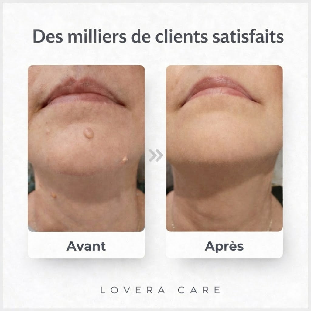 Lovera Care - Pansements pour la Peau
