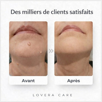 Lovera Care - Pansements pour la Peau