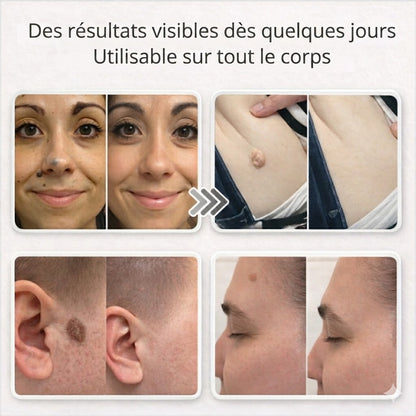 Lovera Care - Pansements pour la Peau